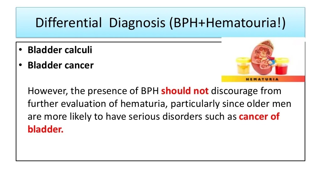 Benign prostatic hyperplasia hesi case study